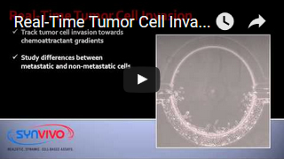 Real-Time Tumor Cell Invasion